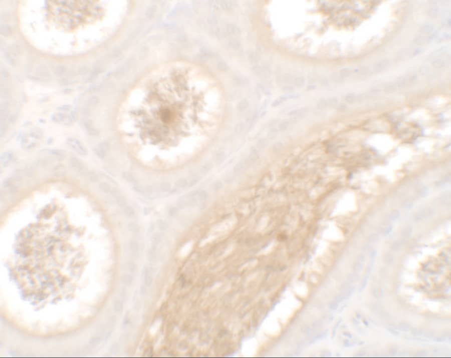 Immunohistochemistry WAC Antibody - BSA Free