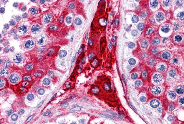 Immunohistochemistry: WDR35 Antibody - BSA Free [NBP2-82058] - Immunohistochemistry of WDR35 in human testis tissue with WDR35 antibody at 5 ug/mL.