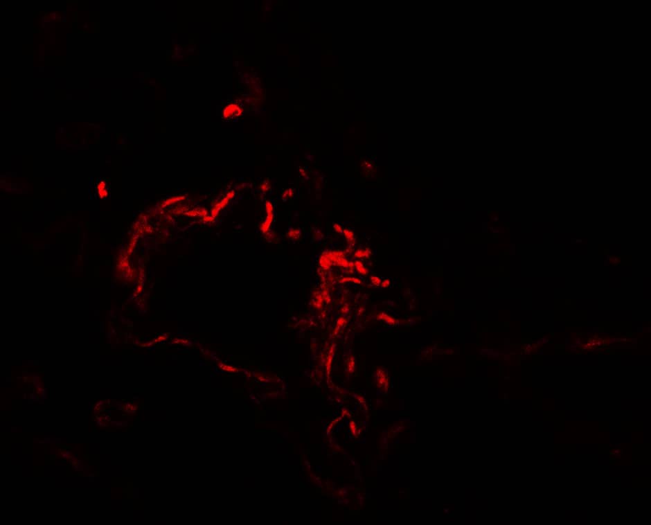 Immunocytochemistry/ Immunofluorescence: ACSL1 Antibody - BSA Free [NBP2-82060] - Immunofluorescence of ACSL1 in human lung tissue with ACSL1 antibody at 20 ug/mL.