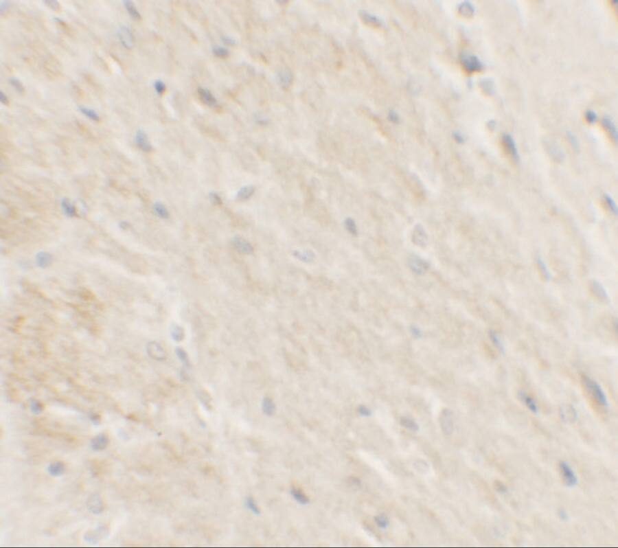 Immunohistochemistry: DDX41 Antibody - BSA Free [NBP2-82061] - Immunohistochemistry of DDX41 in rat brain tissue with DDX41 antibody at 2.5 u/ml.