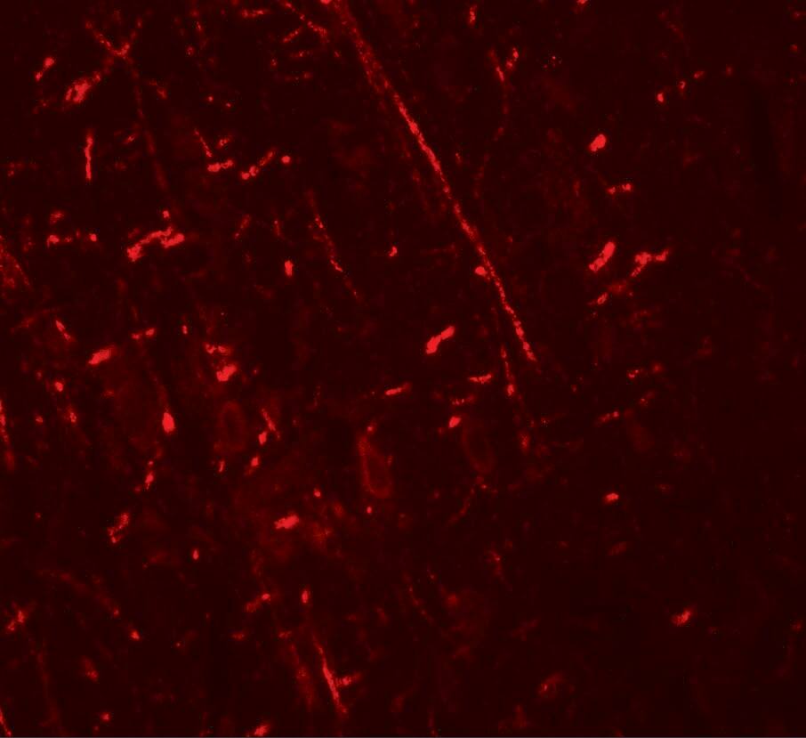 Immunocytochemistry/ Immunofluorescence: DDX41 Antibody - BSA Free [NBP2-82061] - Immunofluorescence of DDX41 in rat brain tissue with DDX41 antibody at 20 u/ml.