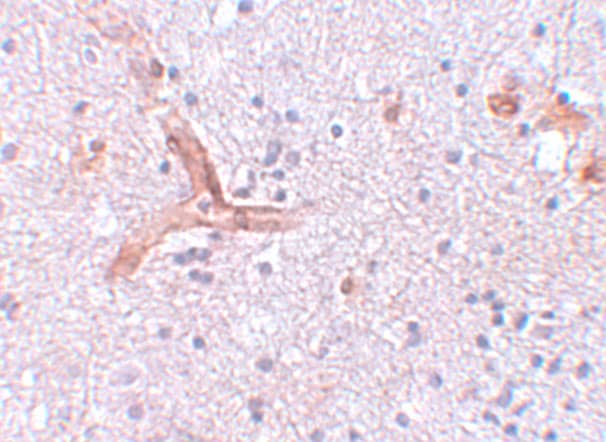Immunohistochemistry ZC3H12C Antibody - BSA Free