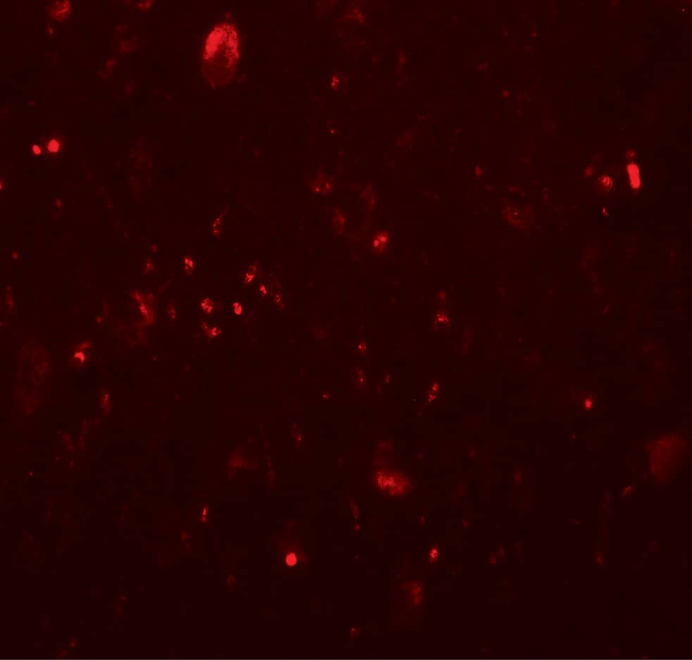 Immunocytochemistry/ Immunofluorescence: TET3 Antibody - BSA Free [NBP2-82066] - Immunofluorescence of TET3 in human brain tissue with TET3 antibody at 20 ug/mL.