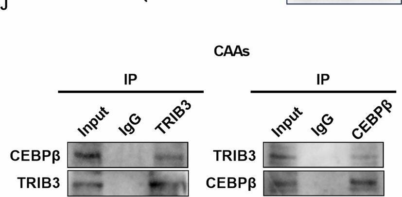 Conditioned medium from OC cells induces CAAs formation via upregulating TRIB3 to suppress phosphorylation of CEBP beta .A Heatmap of differentially expressed genes (DEGs) that are involved in negative regulation of adipocyte differentiation between control adipocytes and CAAs. B Western blot analysis for protein expression levels of TRIB3, DDIT3, and FLCN in adipocytes with treatment as indicated. C Oil red O staining of adipocytes with treatment as indicated. D Western blot analysis for protein expression levels of PPAR gamma , CEBP alpha  and APN in adipocytes with treatment as indicated. E ELISA analysis for concentrations of IL-1 beta  and IL-6 in the medium of adipocytes with treatment as indicated. F Oil red O staining of adipocytes with treatment as indicated. G Western blot analysis for protein expression levels of PPAR gamma , CEBP alpha  and APN in adipocytes with treatment as indicated. H ELISA analysis for concentrations of IL-1 beta  and IL-6 in the medium of adipocytes with treatment as indicated. I Western blot analysis for protein expression levels of TRIB3, CEBP beta , and p-CEBP beta  in adipocytes with treatment as indicated. J Co-IP assay was performed with anti-TRIB3 or anti-CEBP beta  antibodies using extracts prepared from CAAs. The presence of TRIB3 or CEBP beta  in IPs was evaluated by immunoblotting (WB). K Oil red O staining of adipocytes with treatment as indicated. L Western blot analysis for protein expression levels of PPAR gamma , CEBP alpha  and APN in adipocytes with treatment as indicated. Scale bar = 100 um. Data were expressed as mean +/- SEM of three independent experiments. Student’s t test was used for analysis of the data in C, E, F, H and K. *p < 0.05. Image collected and cropped by CiteAb from the following open publication (//www.nature.com/articles/s41419-024-07311-3), licensed under a CC-BY license. Not internally tested by Novus Biologicals.