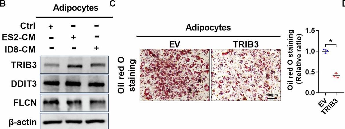 Conditioned medium from OC cells induces CAAs formation via upregulating TRIB3 to suppress phosphorylation of CEBP beta .A Heatmap of differentially expressed genes (DEGs) that are involved in negative regulation of adipocyte differentiation between control adipocytes and CAAs. B Western blot analysis for protein expression levels of TRIB3, DDIT3, and FLCN in adipocytes with treatment as indicated. C Oil red O staining of adipocytes with treatment as indicated. D Western blot analysis for protein expression levels of PPAR gamma , CEBP alpha  and APN in adipocytes with treatment as indicated. E ELISA analysis for concentrations of IL-1 beta  and IL-6 in the medium of adipocytes with treatment as indicated. F Oil red O staining of adipocytes with treatment as indicated. G Western blot analysis for protein expression levels of PPAR gamma , CEBP alpha  and APN in adipocytes with treatment as indicated. H ELISA analysis for concentrations of IL-1 beta  and IL-6 in the medium of adipocytes with treatment as indicated. I Western blot analysis for protein expression levels of TRIB3, CEBP beta , and p-CEBP beta  in adipocytes with treatment as indicated. J Co-IP assay was performed with anti-TRIB3 or anti-CEBP beta  antibodies using extracts prepared from CAAs. The presence of TRIB3 or CEBP beta  in IPs was evaluated by immunoblotting (WB). K Oil red O staining of adipocytes with treatment as indicated. L Western blot analysis for protein expression levels of PPAR gamma , CEBP alpha  and APN in adipocytes with treatment as indicated. Scale bar = 100 um. Data were expressed as mean +/- SEM of three independent experiments. Student’s t test was used for analysis of the data in C, E, F, H and K. *p < 0.05. Image collected and cropped by CiteAb from the following open publication (//www.nature.com/articles/s41419-024-07311-3), licensed under a CC-BY license. Not internally tested by Novus Biologicals.