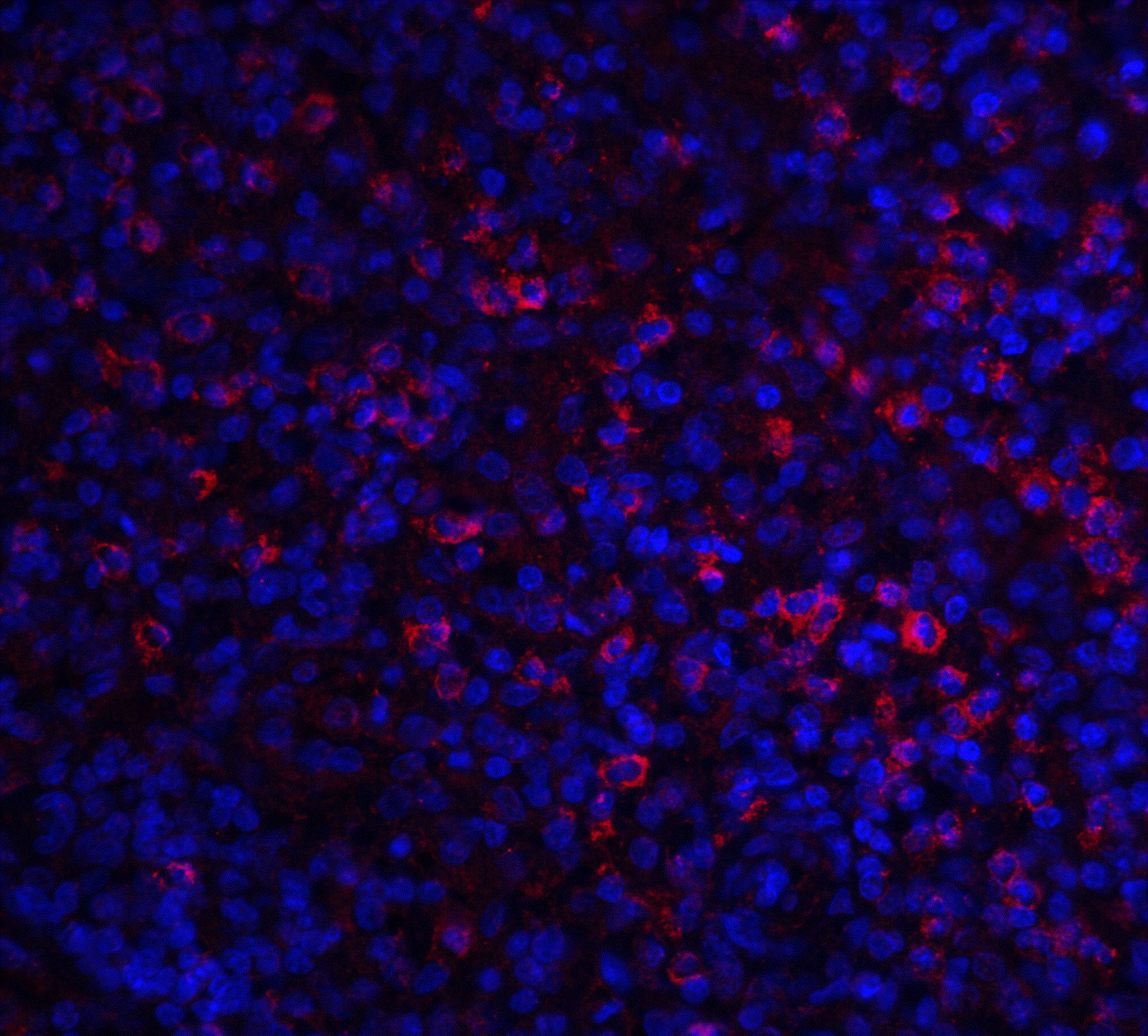 Immunocytochemistry/ Immunofluorescence: ABCA7 Antibody - BSA Free [NBP2-82069] - Immunofluorescence of ABCA7 in human spleen tissue with ABCA7 antibody at 20 ug/ml.Red: ABCA7 Antibody   Blue: DAPI staining