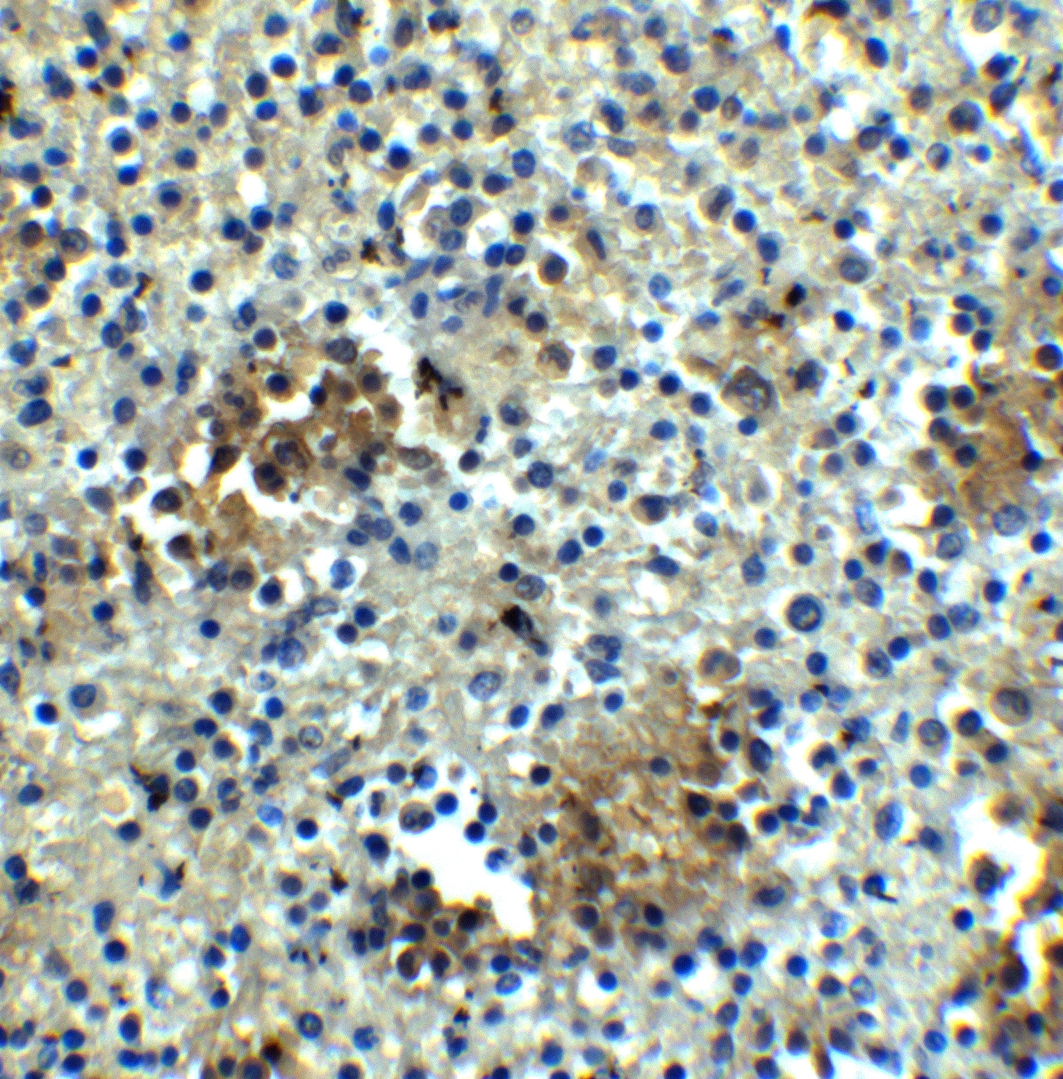 Immunohistochemistry: ABCA7 Antibody - BSA Free [NBP2-82069] - Immunohistochemistry of ABCA7 in human spleen tissue with ABCA7 antibody at 5 ug/mL.