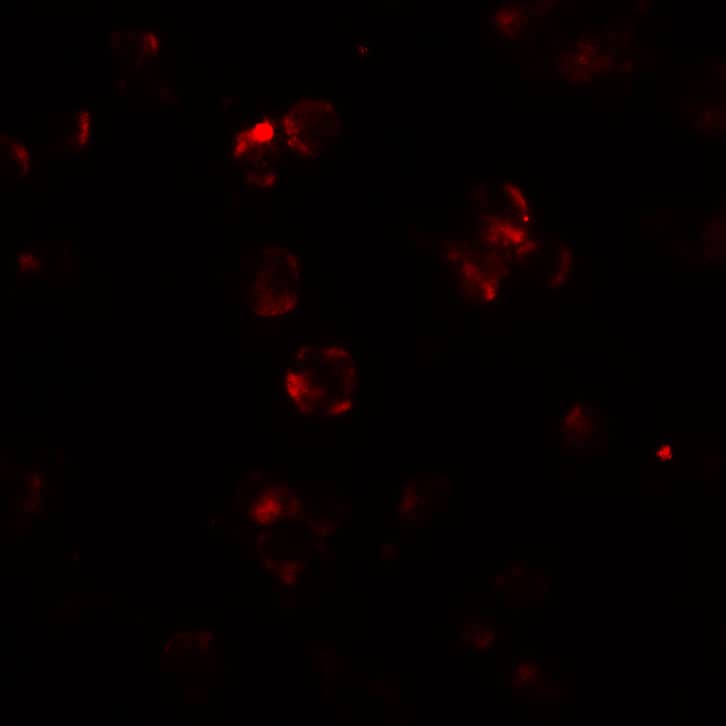 Immunocytochemistry/ Immunofluorescence: ABCA7 Antibody - BSA Free [NBP2-82069] - Immunofluorescence of ABCA7 in 293 cells with ABCA7 antibody at 20 ug/mL.