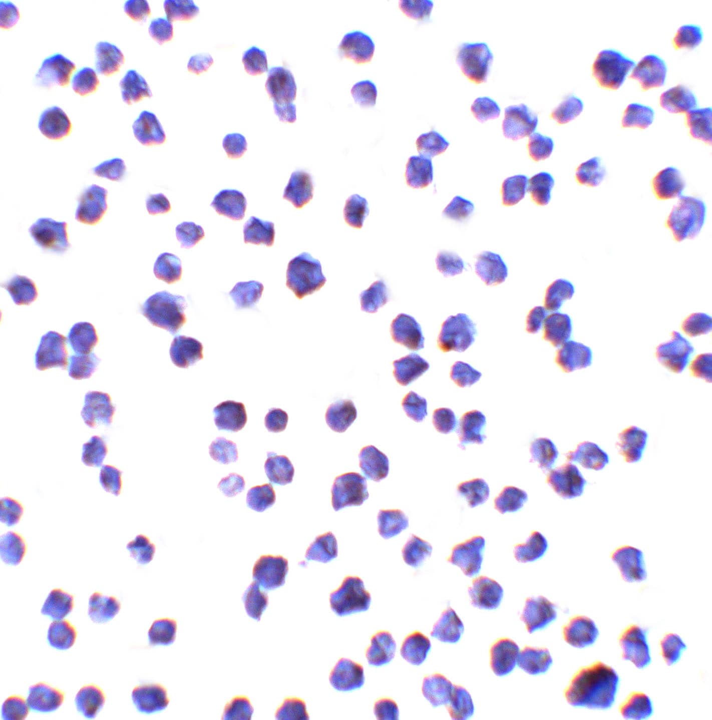 Immunocytochemistry/ Immunofluorescence: C9orf72 Antibody - BSA Free [NBP2-82070] - Immunocytochemistry of C9orf72 in A-20 cells with C9orf72 antibody at 10 ug/ml.