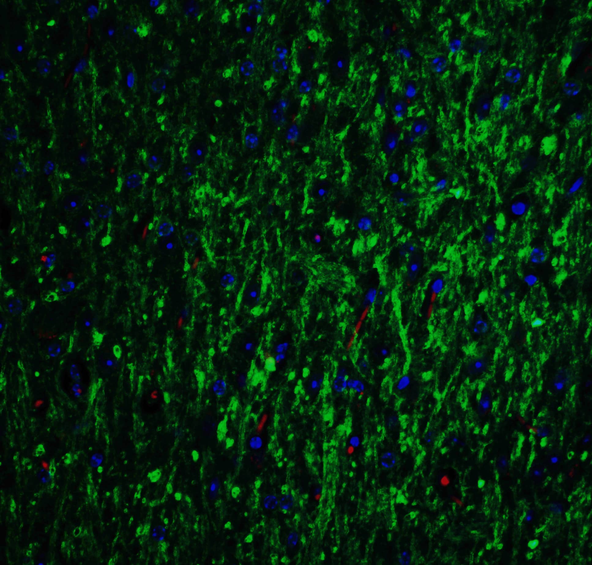 Immunocytochemistry/ Immunofluorescence: GLS2 Antibody - BSA Free [NBP2-82071] - Immunofluorescence of GLS2 in mouse brain tissue with GLS2 Antibody at 20 u/mL.Green: GLS2 antibody   Red: Phylloidin staining Blue: DAPI staining