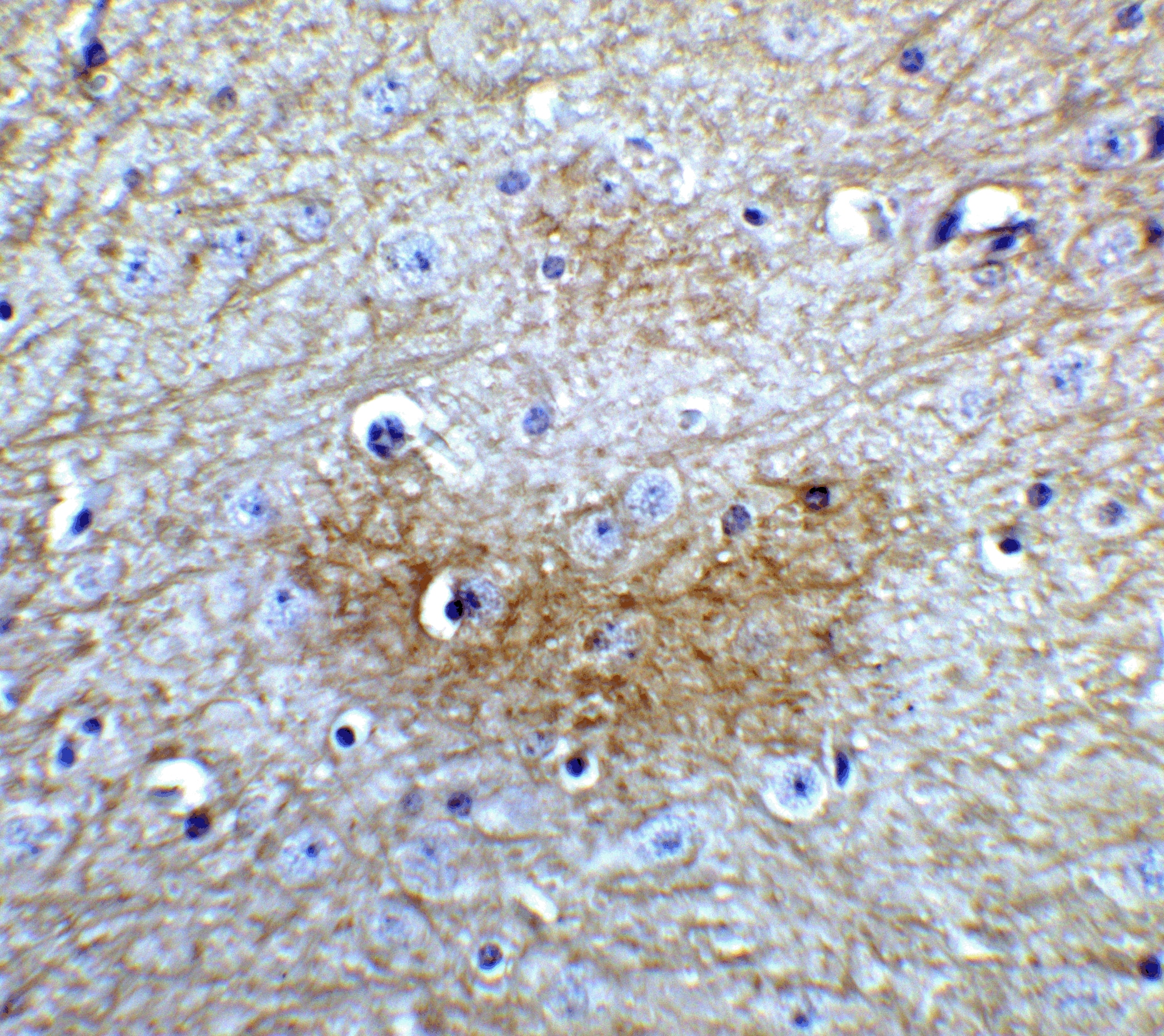 Immunohistochemistry: GLS2 Antibody - BSA Free [NBP2-82071] - Immunohistochemistry of GLS2 in mouse brain tissue with GLS2 Antibody at 5 u/mL.