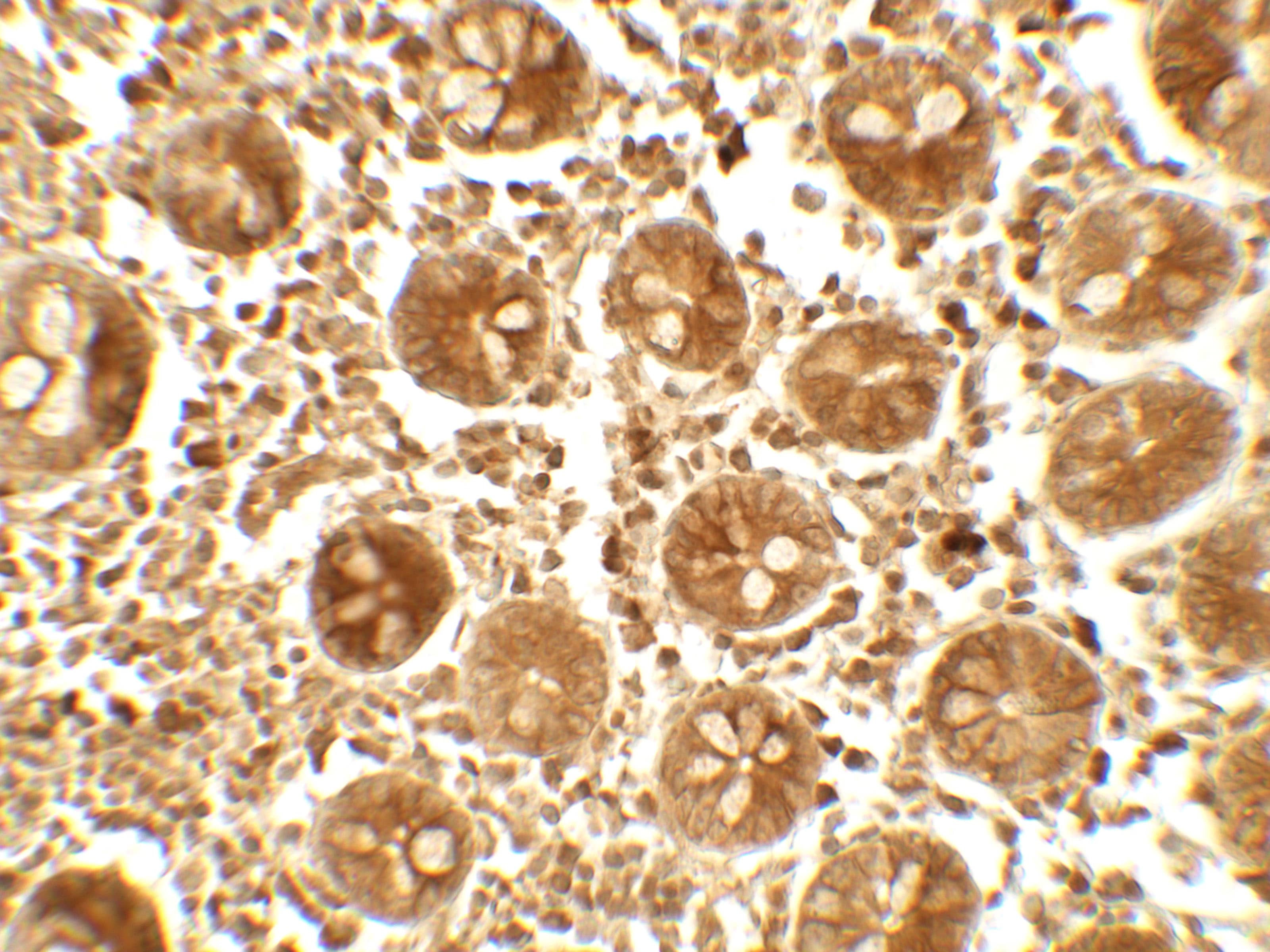 Immunohistochemistry APOBEC3B Antibody - BSA Free