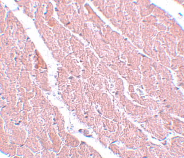 Immunohistochemistry: ATG13 Antibody - BSA Free [NBP2-82074] - Immunohistochemistry of ATG13 in mouse heart with ATG13 antibody at 5 ug/mL.