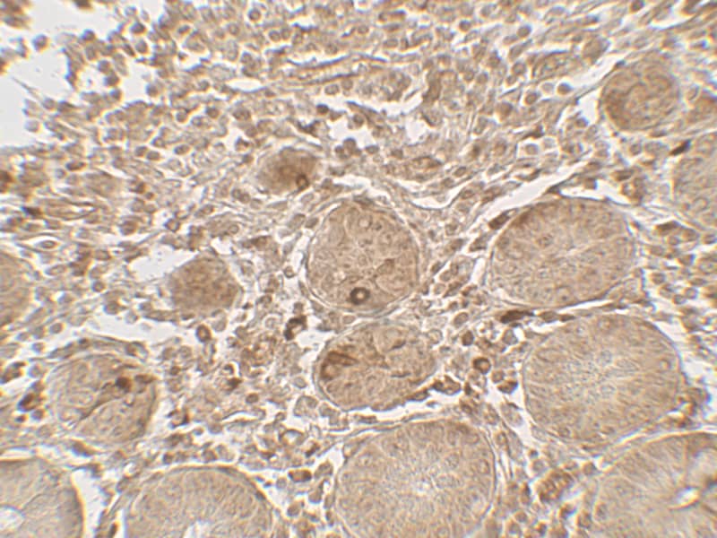 Immunohistochemistry: LAMTOR1 Antibody - BSA Free [NBP2-82075] - Immunohistochemistry of LAMTOR1 in human small intestine tissue with LAMTOR1 antibody at 5 u/mL.