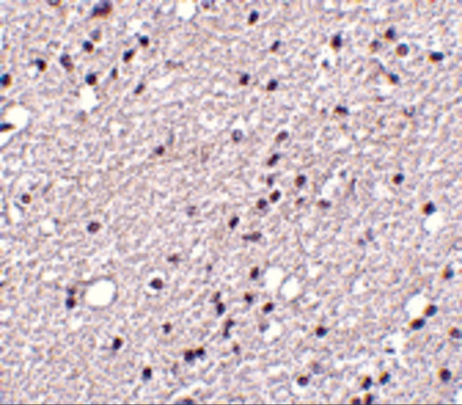 Immunohistochemistry: NK3R/TACR3/Neurokinin B Receptor Antibody - BSA Free [NBP2-82076] - Immunohistochemistry of NK3R/TACR3/Neurokinin B Receptor in human brain tissue with NK3R/TACR3/Neurokinin B Receptor antibody at 5 ug/mL.