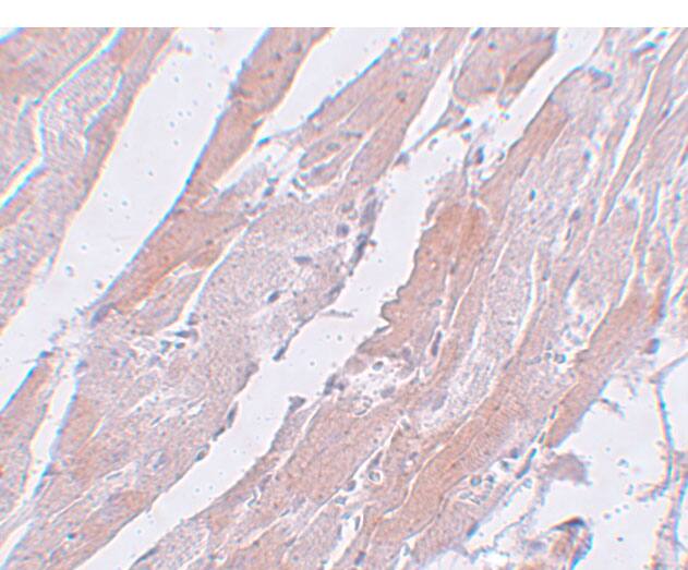 Immunohistochemistry: CCDC47 Antibody - BSA Free [NBP2-82077] - Immunohistochemistry of CCDC47 in mouse heart tissue with CCDC47 antibody at 5 ug/mL.