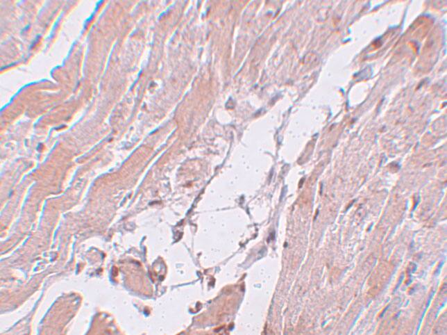 Immunohistochemistry: CCDC47 Antibody - BSA Free [NBP2-82078] - Immunohistochemistry of CCDC47 in mouse heart tissue with CCDC47 antibody at 5 ug/mL.