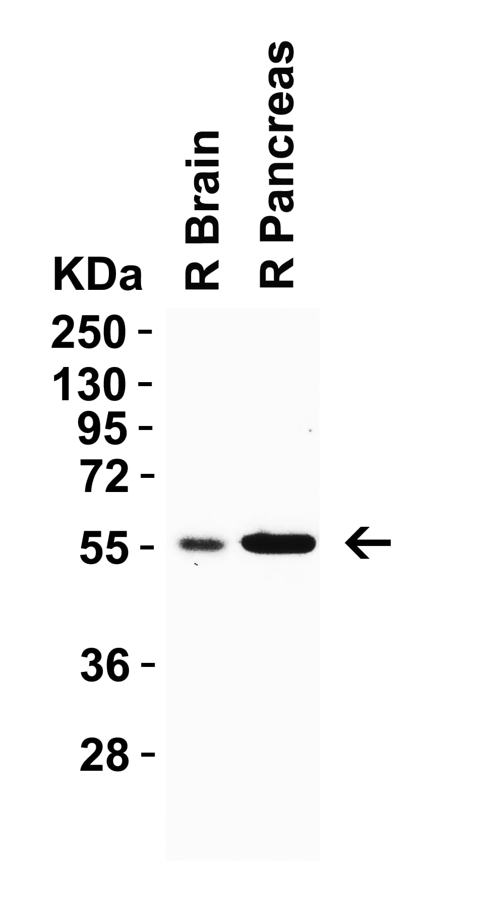 Western Blot: CRBN Antibody - BSA Free [NBP2-82079] - Validation  in Rat Tissues. Loading: 15 ug of rat tissue lysate Antibodies:  CRBN, 0.5 ug/mL , 1h incubation at RT in 5% NFDM/TBST. Secondary: Goat anti-rabbit IgG HRP conjugate at 1:10000 dilution.