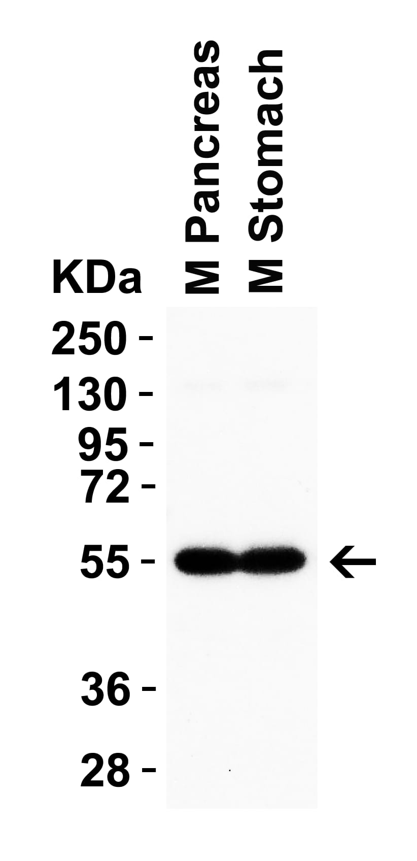 Western Blot: CRBN Antibody - BSA Free [NBP2-82079] - Validation in Mouse Tissues.Loading: 15 ug of mouse tissue lysate Antibodies:  CRBN, 0.5 ug/mL, 1h incubation at RT in 5% NFDM/TBST. Secondary: Goat anti-rabbit IgG HRP conjugate at 1:10000 dilution.