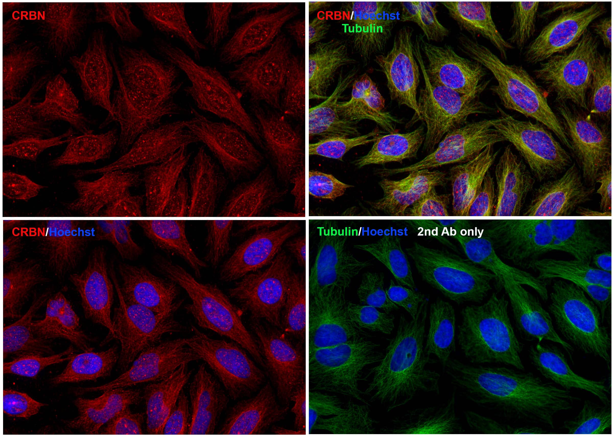 Immunocytochemistry/ Immunofluorescence CRBN Antibody - BSA Free