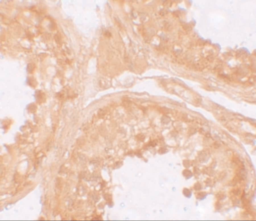 Immunohistochemistry: NLRP9 Antibody - BSA Free [NBP2-82080] - Immunohistochemistry of NLRP9 in human testis tissue with NLRP9 antibody at 10 u/mL.