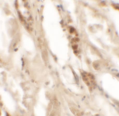 Immunohistochemistry: DBX2 Antibody - BSA Free [NBP2-82083] - Immunohistochemistry of DBX2 in human kidney tissue with DBX2 antibody at 5 ug/mL.