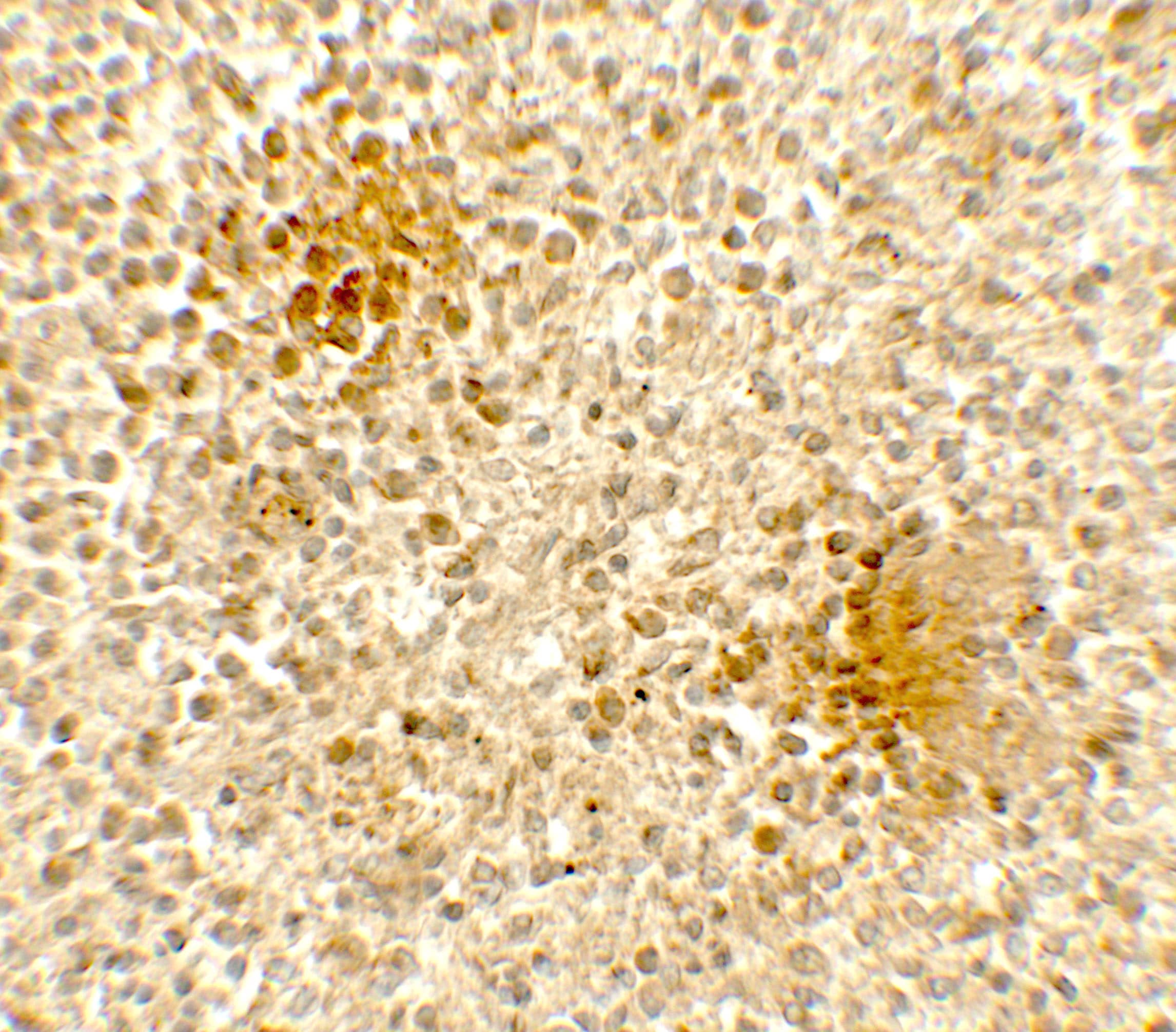 Immunohistochemistry: dedicator of cytokinesis 8 Antibody - BSA Free [NBP2-82084] - Immunohistochemistry of dedicator of cytokinesis 8 in human spleen tissue with dedicator of cytokinesis 8 antibody at 5 ug/mL.