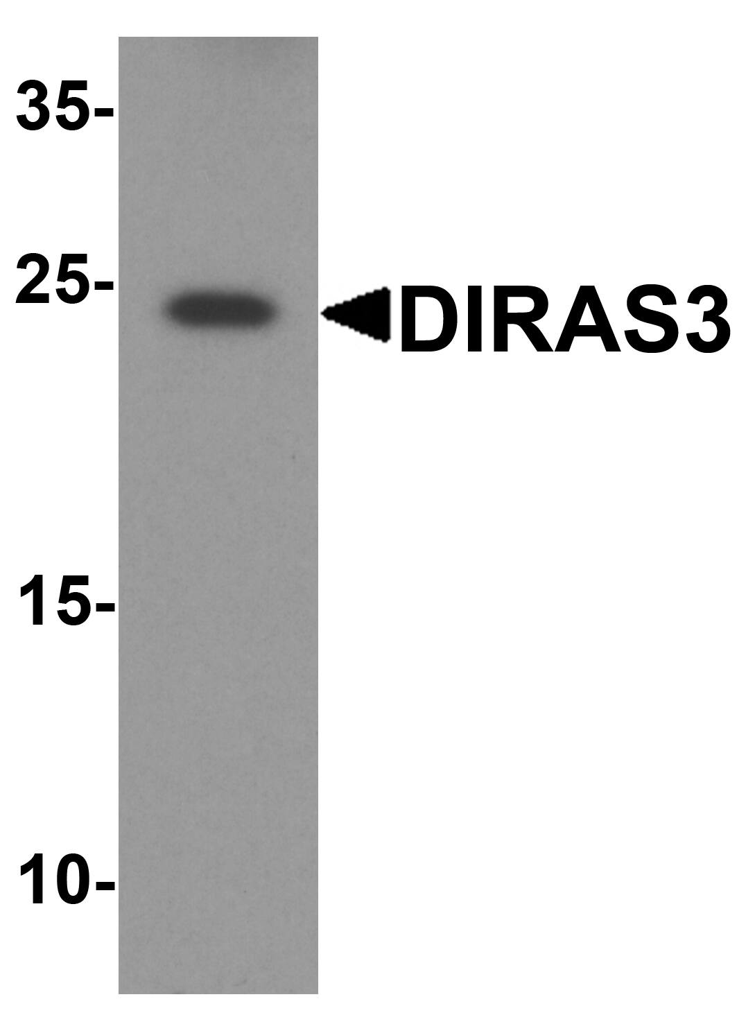 Western Blot: DIRAS3 Antibody - BSA Free [NBP2-82085] - Western blot analysis of DIRAS3 in human testis tissue lysate with DIRAS3 antibody at 1 u/ml.