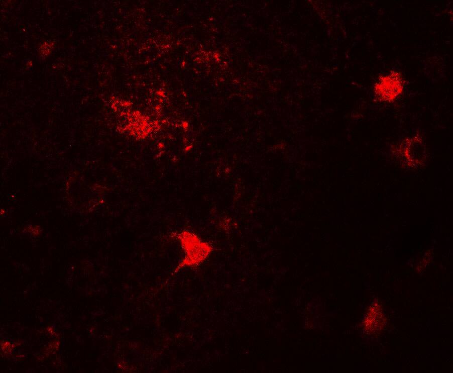 Immunocytochemistry/ Immunofluorescence: DPF3 Antibody - BSA Free [NBP2-82087] - Immunofluorescence of DPF3 in human brain tissue with DPF3 antibody at 20 ug/mL.