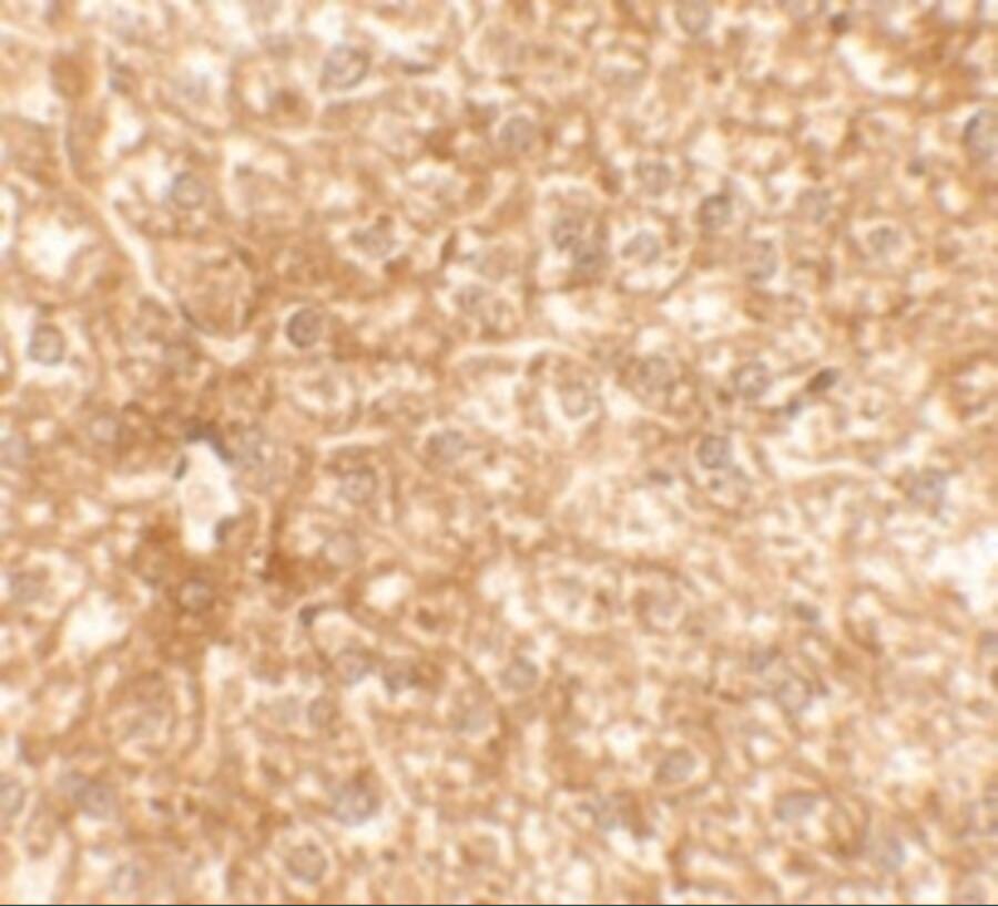 Immunohistochemistry: Epac2 Antibody - BSA Free [NBP2-82089] - Immunohistochemistry of EPAC3 in mouse liver tissue with EPAC3 antibody at 2.5 ug/mL.