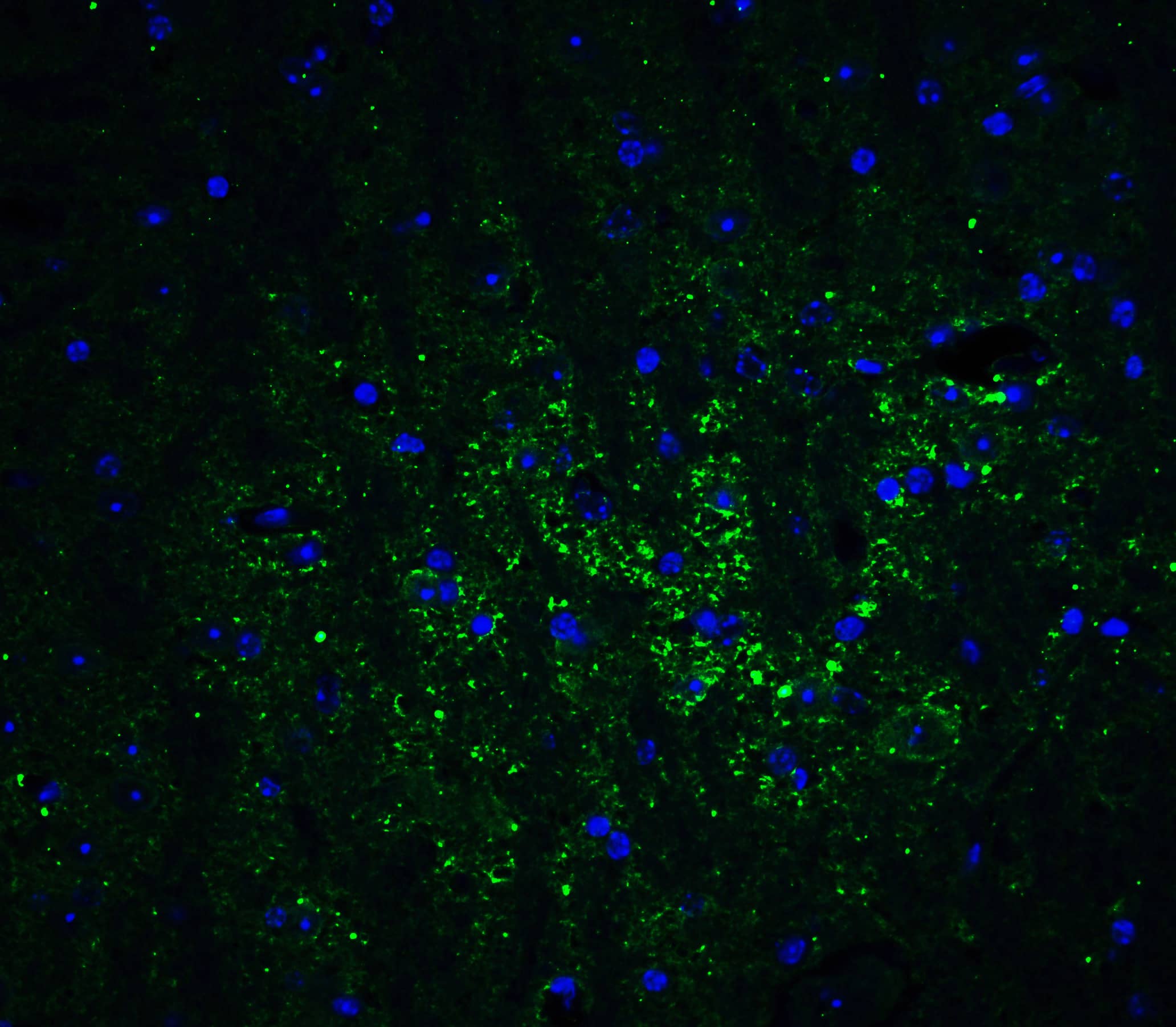 Immunocytochemistry/ Immunofluorescence: GATE-16/GABARAPL2 Antibody - BSA Free [NBP2-82090] - Immunofluorescence of GATE-16/GABARAPL2 in mouse brain tissue with GATE-16/GABARAPL2 Antibody at 20 ug/mL.Green: GATE-16/GABARAPL2 Antibody   Blue: DAPI staining