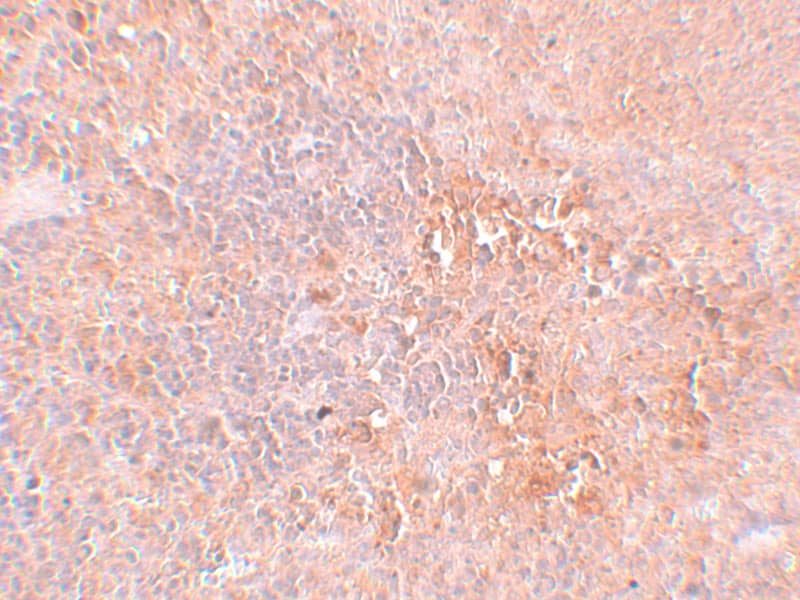 Immunohistochemistry JMJD4 Antibody - BSA Free
