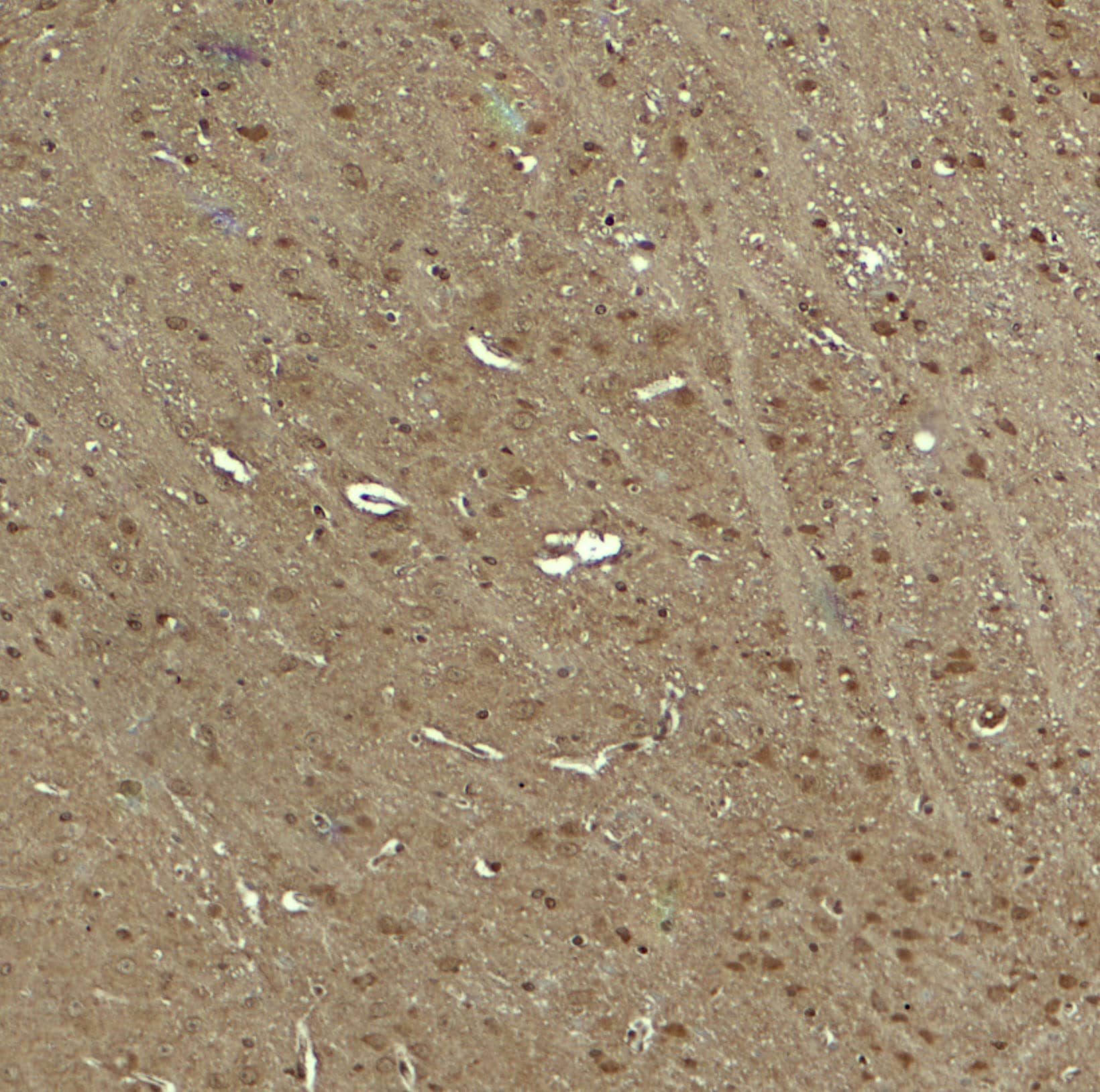 Immunohistochemistry: KIBRA Antibody - BSA Free [NBP2-82101] - Immunohistochemistry of KIBRA in mouse brain tissue with KIBRA antibody at 5 u/ml.