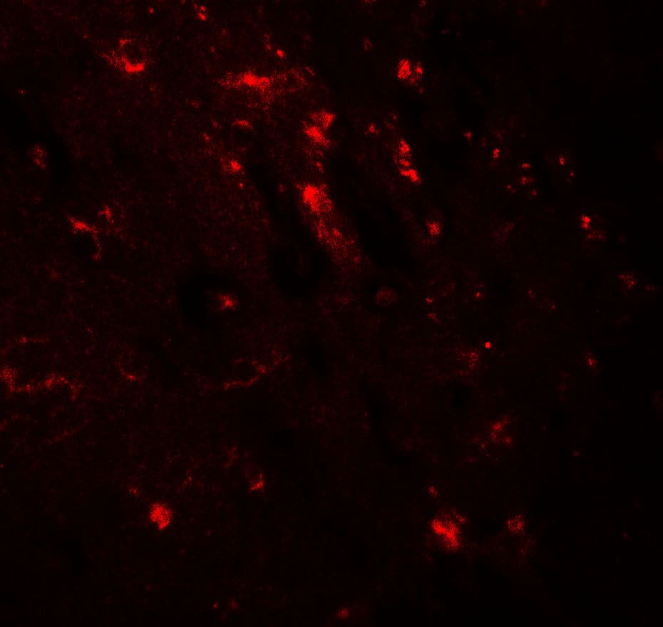 Immunocytochemistry/ Immunofluorescence: KIBRA Antibody - BSA Free [NBP2-82101] - Immunofluorescence of KIBRA in mouse brain tissue with KIBRA antibody at 20 u/ml.