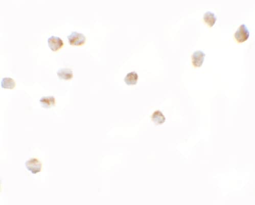 Immunocytochemistry/ Immunofluorescence: LEMD2 Antibody - BSA Free [NBP2-82103] - Immunocytochemistry of LEMD2 in 3T3 cells with LEMD2 antibody at 2.5 ug/mL.
