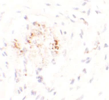 Immunohistochemistry: LEMD3 Antibody - BSA Free [NBP2-82104] - Immunohistochemistry of LEMD3 in human colon tissue with LEMD3 antibody at 2.5 ug/mL.