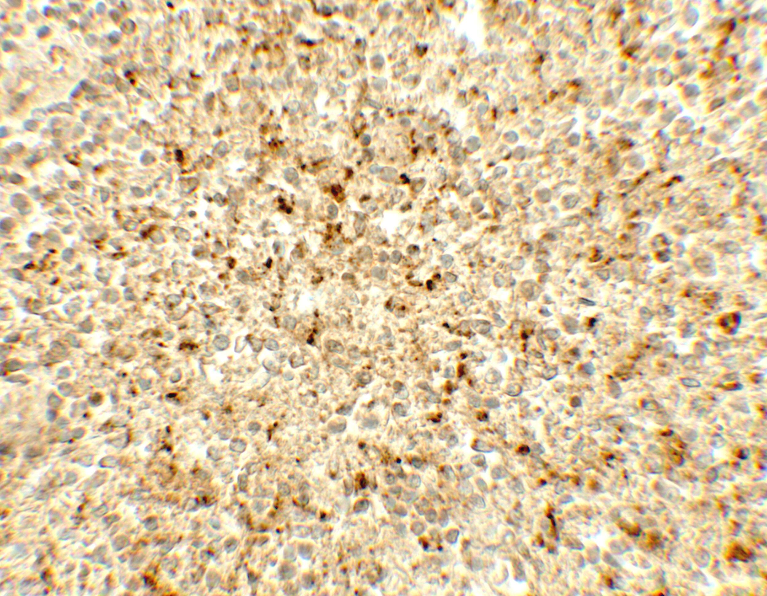 Immunohistochemistry: ME2 Antibody - BSA Free [NBP2-82105] - Immunohistochemistry of ME2 in human spleen tissue with ME2 antibody at 5 u/mL.