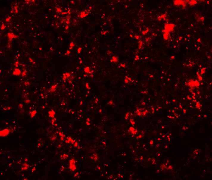 Immunocytochemistry/ Immunofluorescence: ME2 Antibody - BSA Free [NBP2-82105] - Immunofluorescence of ME2 in human spleen tissue with ME2 antibody at 20 ug/mL.