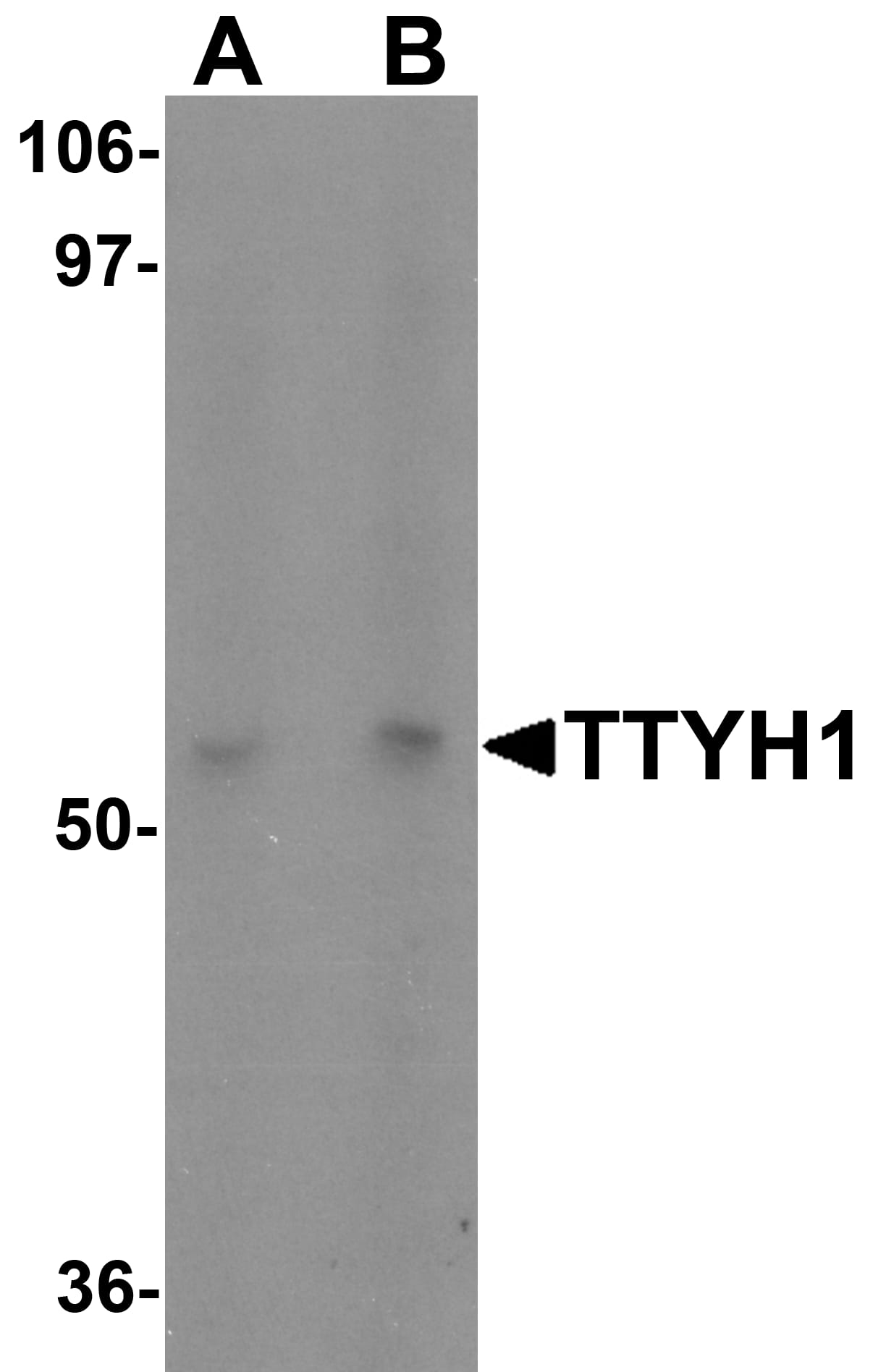 Western Blot: TTYH1 Antibody - BSA Free [NBP2-82108] - Western blot analysis of TTYH1 in Raji cell lysate with TTYH1 antibody at (A) 1 and (B) 2 u/mL.