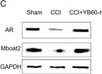 YB60 modulates ferroptosis and the AR/Mboat2 axis in Spinal Cord Neurons. (A) Fluorescence double-label staining of AR (green) and c-Fos (red) in the Sham (a1, a4), CCI (a2, a5) and CCI + YB60-H (a3, a6) groups. DAPI (blue) staining highlights nuclei. Scale bars: 500 μm (a1- a3); 100 μm (a4- a6). (B) Fluorescence double-label staining of Mboat2 (green) and c-Fos (red) in the sham (b1, b4), CCI (b2, b5) and CCI + YB60-H (b3, b6) groups. DAPI (blue) staining highlights nuclei. Scale bars: 500 μm (b1- b3); 100 μm (b4- b6). (C) Expression levels of AR and Mboat2. (D-E) Semiquantitative analysis of AR (D) and Mboat2 (E), n = 3. The error bars represent the SD. **P < 0.01. Image collected and cropped by CiteAb from the following open publication (//pubmed.ncbi.nlm.nih.gov/40201699), licensed under a CC-BY license. Not internally tested by Novus Biologicals.