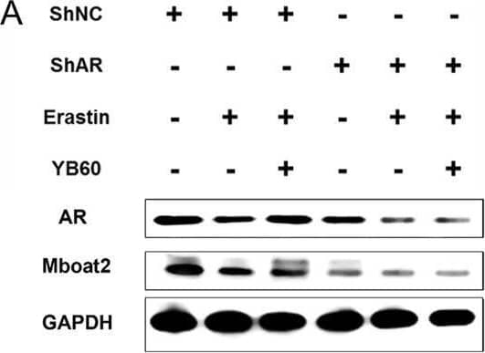 YB60 inhibited Erastin-induced ferroptosis by regulating AR/Mboat2 in PC12 cells. (A) Expression levels of AR and Mboat2 in PC12 cells. (B-C) Semiquantitative analysis of AR (B) and Mboat2 (C), n = 3. D-F. Contents of iron ions (D), ROS (E) and MDA (F) in various groups, n = 6. (G) Viability of PC12 cells. The error bars represent the SD. **P < 0.01. Image collected and cropped by CiteAb from the following open publication (//pubmed.ncbi.nlm.nih.gov/40201699), licensed under a CC-BY license. Not internally tested by Novus Biologicals.