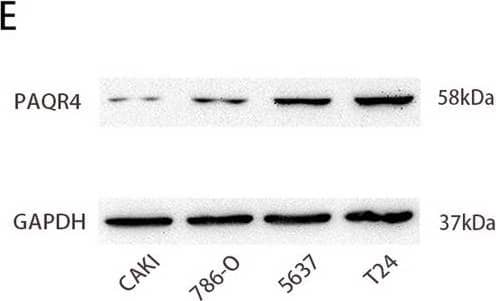Western Blot PAQR4 Antibody - BSA Free