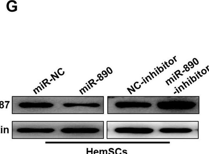 Circ_0000915 up-regulated RNF187 via inhibition of miR-890 in HemSCs. A The prediction for miR-890 binding sites on RNF187 transcripts and schematic of luciferase reporter vector constructs RNF187 3’UTR wild-type (RNF187 3’UTR-wt) and the miR-890-binding-site mutated (RNF187 3’UTR-mt) one. B Biotin-coupled miR-890 (Biotin-miR-890) captured a fold change of RNF187 mRNA in the complex as compared with biotin-coupled miR-NC (Biotin-miR-NC) in biotin-coupled miRNA capture in HemSCs. C, D The luciferase activities in HemSCs and HEK 293t cells co-transfected with miR-890 or miR-NC mimics and luciferase reporters containing RNF187 3’UTR-wt or RNF187 3’UTR-mt. E–G Expression of RNF187 in HemSCs transfected with miR-890 mimics and miR-890 inhibitor or their corresponding negative control was measured by qRT-PCR and Western blot. H–J Expression of RNF187 in Circ_0000915-silent and Circ_0000915-overexpressing HemSCs was measured by qRT-PCR and Western blot. Data are presented as mean +/- S.D from three independent experiments. *P < 0.05; **P < 0.011; ns = not significant. Student’s t-test Image collected and cropped by CiteAb from the following open publication (//pubmed.ncbi.nlm.nih.gov/36167680), licensed under a CC-BY license. Not internally tested by Novus Biologicals.