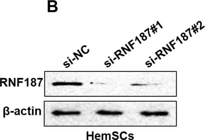 Depletion of RNF187 impaired propranolol resistance of HemSCs. A, B mRNA and protein levels of RNF187 in HemSCs transfected with specific siRNAs against RNF187 (si-RNF187#1 and si-RNF187#2) or siRNA negative control (si-NC) were detected qRT-PCR and Western blot, respectively. C CCK-8 assay showed cell viability of HemSCs exposed to different concentration of propranolol for 72 h after transfection with si-RNF187#1, si-RNF187#2 or si-NC. D IC50 value of propranolol (72 h treatment) was calculated after HemSCs were transfected with si-RNF187#1, si-RNF187#2 or si-NC. E, F Expression of proliferative-related markers (Cyclin D1 and PCNA) in RNF187-silent HemSCs exposed to propranolol (20 μM) for 48 h was measured by qRT-PCR and Western blot, respectively. G, H Cell apoptosis of RNF187-silent HemSCs exposed to propranolol (20 μM) for 48 h were determined by caspase-3 activity assay (G) and Annexin-V/PI double staining assay (H). *P < 0.05; **P < 0.01; ***P < 0.001. (Two-way ANOVA for C, Student’s t-test for others) Image collected and cropped by CiteAb from the following open publication (//pubmed.ncbi.nlm.nih.gov/36167680), licensed under a CC-BY license. Not internally tested by Novus Biologicals.
