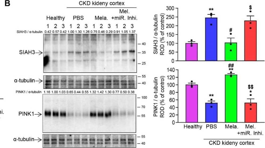 Melatonin injection ameliorates fibrotic CKD and improves kidney function in a CKD mouse model via miR-4516/SIAH3/PINK1 pathway. (A) miR-4516 expression level in renal cortex of healthy kidney control and CKD mice either treated with melatonin, or both melatonin and miR-4516 inhibitor, measured by qRT-PCR (n = 3). (B) Expression of SIAH3 and PINK1 in renal cortex of each groups. Protein expression level was quantified by densitometry and normalized to  alpha -tubulin levels (n = 3). (C) IHC staining for SIAH3 in renal cortex of each mouse group. (D) H&E staining of renal cortex of each mouse group. (E,F) Measurement of blood urea nitrogen (E) and creatinine (F) level in serum of each mouse group (n = 5). The values represent mean +/- SEM, * p < 0.05, ** p < 0.01 versus healthy kidney control; #p < 0.05, ##p < 0.01 versus PBS; $p < 0.05, $$p < 0.01 versus melatonin. The  alpha -tubulin was used as Western blot loading control for whole tissue lysates. Image collected and cropped by CiteAb from the following open publication (//pubmed.ncbi.nlm.nih.gov/34359852), licensed under a CC-BY license. Not internally tested by Novus Biologicals.