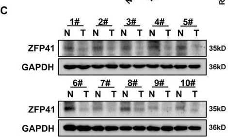 Downregulated ZFP41 is correlated with poor survival in HCC patients. (A) The IHC staining results of tissue microarray from Tongji hospital HCC patients. (B) qPCR results showed that ZFP41 was highly expressed in normal tissues rather than tumor tissues in 63 pairs samples from HCC patients. The relevance of 63 pairs of HCC patient samples was calculated. (C) Western blots results showed the ZFP41 protein level in both tumor and normal tissues. The relevance of 40 pairs of HCC patient samples was demonstrated. (D) qPCR results showed that the mRNA level of ZFP41 in normal hepatocyte cell and other HCC cells. (E) Western blots results showed that the protein level of ZFP41 in normal hepatocyte cell and other HCC cells. (F) The overall survival prognosis of patients determined on the basis of ZFP41 expression in Tongji cohort and TCGA database. Image collected and cropped by CiteAb from the following open publication (//pubmed.ncbi.nlm.nih.gov/39473907), licensed under a CC-BY license. Not internally tested by Novus Biologicals.