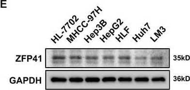 Downregulated ZFP41 is correlated with poor survival in HCC patients. (A) The IHC staining results of tissue microarray from Tongji hospital HCC patients. (B) qPCR results showed that ZFP41 was highly expressed in normal tissues rather than tumor tissues in 63 pairs samples from HCC patients. The relevance of 63 pairs of HCC patient samples was calculated. (C) Western blots results showed the ZFP41 protein level in both tumor and normal tissues. The relevance of 40 pairs of HCC patient samples was demonstrated. (D) qPCR results showed that the mRNA level of ZFP41 in normal hepatocyte cell and other HCC cells. (E) Western blots results showed that the protein level of ZFP41 in normal hepatocyte cell and other HCC cells. (F) The overall survival prognosis of patients determined on the basis of ZFP41 expression in Tongji cohort and TCGA database. Image collected and cropped by CiteAb from the following open publication (//pubmed.ncbi.nlm.nih.gov/39473907), licensed under a CC-BY license. Not internally tested by Novus Biologicals.