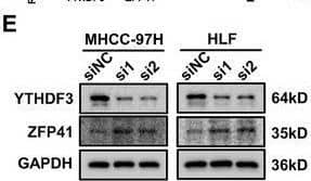 YTHDF3‐mediated m6A modification of ZFP41 mRNA and decays its mRNA stability. (A) qPCR results showed that efficiencies of siRNA‐mediated knockdown of common m6A regulators in MHCC‐97H cells. (B) qPCR results showed that expression of ZFP41 after silencing these m6A regulators in MHCC‐97H cells. (C) Overexpression of YTHDF3 notably suppress ZFP41 expression on transcription level in MHCC‐97H and Hep3B cells. (D) Knockdown of YTHDF3 obviously increase ZFP41 expression on mRNA level in MHCC‐97H and Hep3B cells. (E) Western blots results demonstrated that the ZFP41 protein level in MHCC‐97H and HLF cells after silencing YTHDF3 with siRNA of YTHDF3. (F) Western blots results demonstrated that the ZFP41 protein level in Hep3B cells after overexpression of YTHDF3. (G) The diagram of the potential site of m6A modification on the CDS (Coding Sequence) area. (H) The luciferase activity in both MHCC‐97H and Hep3B cells cotransfected with relative plasmids. (I) MeRIP results showed that ZFP41‐wt or ZFP41‐mut in both MHCC‐97H and Hep3B cells. (J) The rate of ZFP41 mRNA degradation in MHCC‐97H and Hep3B cells with YTHDF3 overexpression or knockdown. (K) The binding of ZFP41 mRNA and YTHDF3 was tested in MHCC‐97H and Hep3B cells by RIP‐qPCR analyses. (L) The relationship between ZFP41 and YTHDF3 was confirmed by RNA pull‐down assay. Image collected and cropped by CiteAb from the following open publication (//pubmed.ncbi.nlm.nih.gov/39473907), licensed under a CC-BY license. Not internally tested by Novus Biologicals.