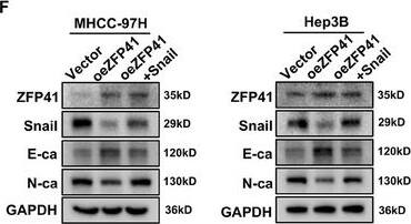 ZFP41 suppresses the proliferation and invasion of HCC cells by inhibiting Snail expression and EMT pathway. (A) Representative images of subcutaneous xenograft tumors formation of the Vector group, oeZFP41 group and oeZFP41+Snail group in MHCC‐97H cells. The dissected tumors from two groups were photographed. (B) Volumes and Weights of subcutaneous xenograft tumors in the Vector group, oeZFP41 group and oeZFP41+Snail group. (C and D) The lung fluorescence and the number of lung metastatic nodules was calculated in each group. (E) HE staining of lung tissue in each group were presented. (F) Western blots results showed the protein level of Snail and EMT‐related targets with Vector, oeZFP41, and oeZFP41+Snail groups in MHCC‐97H and Hep3B cells. Image collected and cropped by CiteAb from the following open publication (//pubmed.ncbi.nlm.nih.gov/39473907), licensed under a CC-BY license. Not internally tested by Novus Biologicals.