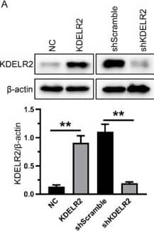 Knockdown Validated KDELR2 Antibody - BSA Free